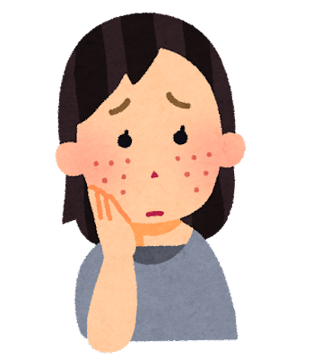 帯状疱疹について